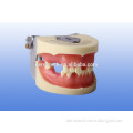 dental implant model , transpartnet dental implant model ,implant dental model